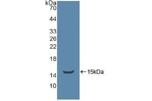 Western blot analysis of recombinant Human ADRbK1. (TEK anticorps  (AA 1-116))