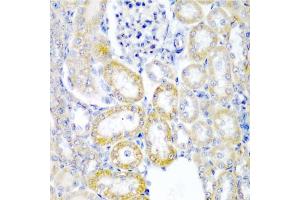 Immunohistochemistry of paraffin-embedded rat kidney using UPF2 antibody. (RENT2/UPF2 anticorps)