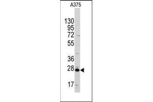 Western blot analysis of anti-CLIC1 Antibody in A375 cell line lysates (35ug/lane). (CLIC1 anticorps)