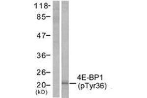 Western blot analysis of extracts from MDA-MB-435 cells treated with EGF 200ng/ml 30', using 4E-BP1 (Phospho-Thr36) Antibody.