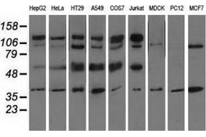 Western blot analysis of extracts (35 µg) from 9 different cell lines by using anti-CD5 monoclonal antibody. (CD5 anticorps)