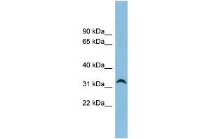 WB Suggested Anti-NXPH4 Antibody Titration: 0. (Neurexophilin 4 anticorps  (N-Term))