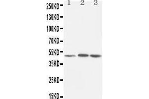 Anti-LXR alpha antibody, Western blotting Lane 1: Rat Liver Tissue Lysate Lane 2: MCF-7 Cell Lysate Lane 3: HELA Cell Lysate (NR1H3 anticorps  (C-Term))