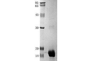 Validation with Western Blot (Estrogen Receptor alpha Protein (Transcript Variant 1) (His tag))