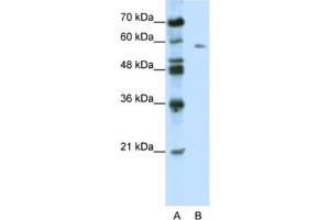 Western Blotting (WB) image for anti-BTB (POZ) Domain Containing 14A (BTBD14A) antibody (ABIN2461017) (BTBD14A anticorps)