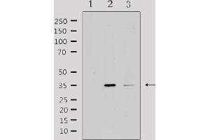 IL20RB antibody  (Internal Region)