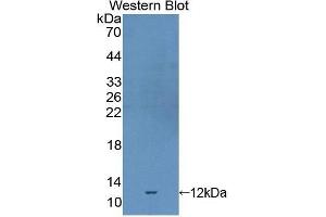 Western Blotting (WB) image for anti-Selenoprotein X, 1 (SEPX1) (AA 1-116) antibody (ABIN1860532) (MSRB1 anticorps  (AA 1-116))