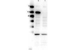 Western Blot of Rabbit Anti-PARP1 (internal) Antibody.