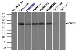 Image no. 1 for anti-Checkpoint Kinase 2 (CHEK2) antibody (ABIN1497498)