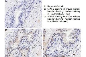 Immunohistochemistry with anti-STAT2 pY690 antibody showing nuclear positivity in epithelial cells of mouse urinary bladder tissue at 20x and 40x (B & C).