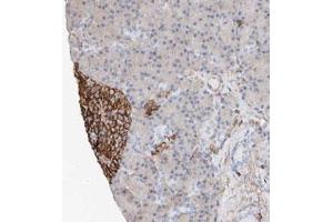 Immunohistochemical staining (Formalin-fixed paraffin-embedded sections) of human pancreas with WFS1 polyclonal antibody  shows strong membrane and cytoplasmic positivity in islet cells. (WFS1 anticorps)