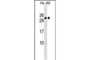 Western blot analysis in HL-60 cell line lysates (35ug/lane). (PTPRCAP anticorps  (AA 90-118))
