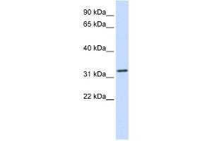 WB Suggested Anti-TPM1 Antibody Titration:  0. (Tropomyosin anticorps  (Middle Region))