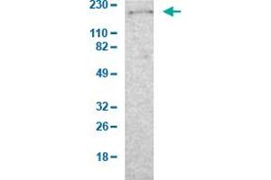 Western Blot analysis of human cell line RT-4. (Laminin beta 1 anticorps  (AA 652-790))