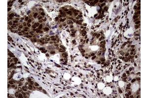 Image no. 6 for anti-Nibrin (NBN) (AA 183-460) antibody (ABIN1491058)