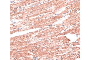 Immunohistochemistry of paraffin-embedded Mouse heart using LMO4 Polyclonal Antibody at dilution of 1:100 (40x lens).