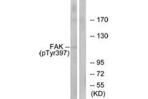 Western blot analysis of extracts from 293 cells treated with EGF 200ng/ml 30', using FAK (Phospho-Tyr397) Antibody. (FAK anticorps  (pTyr397))