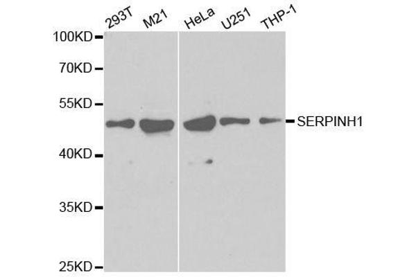 SERPINH1 anticorps  (AA 139-418)