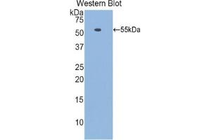 Detection of Recombinant LAMb1, Mouse using Polyclonal Antibody to Laminin Beta 1 (LAMb1)