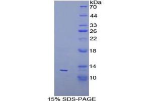 SDS-PAGE of Protein Standard from the Kit (Highly purified E. (PEX2 Kit ELISA)