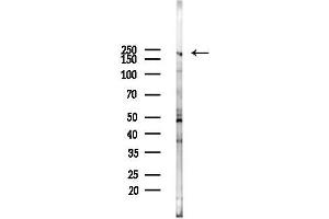 Western blot analysis of lysates from  cells, using Brd4 Antibody at 1/1000 dilution.