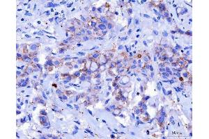 IHC analysis of Desmoglein 2/DSG2 using anti-Desmoglein 2/DSG2 antibody (ABIN7600804). (Desmoglein 2 anticorps  (AA 24-1020))