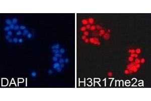 Immunofluorescence analysis of 293T cell using H3R17me2a antibody. (Histone anticorps)