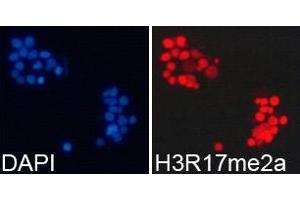 Immunofluorescence analysis of 293T cell using H3R17me2a antibody. (Histone 3 anticorps  (H3R17me2a))