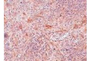 Immunohistochemistry of ABIN3 in mouse spleen tissue with ABIN3 antibody at 5 μg/ml. (TNIP3 anticorps  (C-Term))