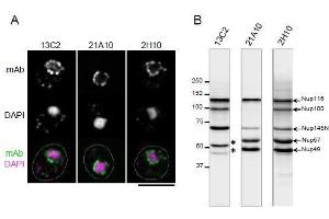 Immunohistochemistry (IHC) image for anti-Nucleoporin 98kDa (NUP98) (FGxxN Motif), (N-Term) antibody (ABIN2452065)