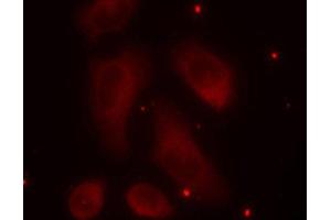 Immunofluorescence staining of methanol-fixed Hela cells using Phospho-LIMK1-T508 antibody.