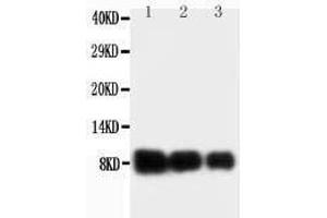 Anti-IL-8 antibody, Western blotting Lane 1: Recombinant Human IL-18 Protein 10ng Lane 2: Recombinant Human IL-18 Protein 5ng Lane 3: Recombinant Human IL-18 Protein 2.