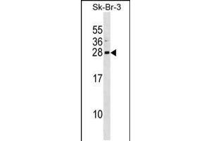 Western blot analysis in SK-BR-3 cell line lysates (35ug/lane). (ARL1 anticorps  (AA 81-108))