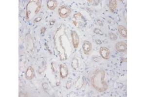 Immunohistochemistry of paraffin-embedded human kidney using ZNF91 antibody at dilution 1:100.