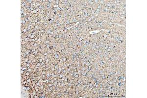 IHC analysis of TNR using anti-TNR antibody (ABIN4886752).