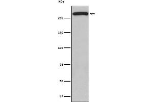 Western blot analysis of ATM expression in 293 cell lysate.