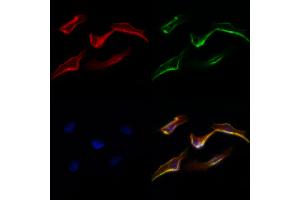 ABIN6265714 and ABIN6277332 staining Hela cells by IF/ICC. (TRAP1 anticorps  (Internal Region))