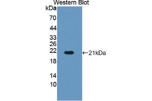 Detection of Recombinant HBb, Bovine using Polyclonal Antibody to Hemoglobin Beta (HBb)
