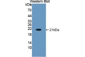 Detection of Recombinant HBb, Bovine using Polyclonal Antibody to Hemoglobin Beta (HBb) (Hemoglobin Subunit beta anticorps  (AA 1-145))