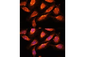 Immunofluorescence analysis of U-2 OS cells using RA antibody (ABIN7269798) at dilution of 1:100.