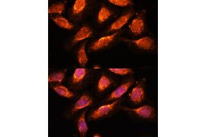 Immunofluorescence analysis of U-2 OS cells using RA antibody (ABIN7269798) at dilution of 1:100. (RAB1A anticorps  (AA 1-205))