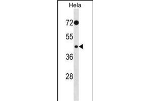 PHKG2 Antibody (E56) (ABIN391341 and ABIN2841365) western blot analysis in Hela cell line lysates (35 μg/lane).