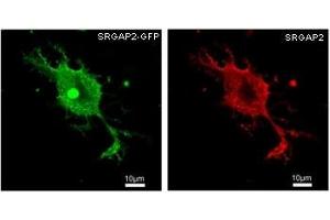 HEK293 overexpressing human SRGAP2 and probed with GFP (green) and SRGAP2 (red) antibody at 2. (SRGAP2 anticorps)