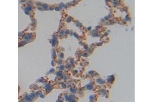 Figure. (IL3RA anticorps  (AA 17-166))