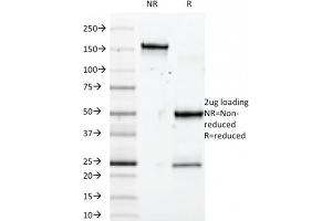 SDS-PAGE Analysis Purified SOX10 Mouse Monoclonal Antibody (SOX10/992). (SOX10 anticorps  (AA 115-269))
