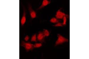ABIN6275007 staining HT29 by IF/ICC.