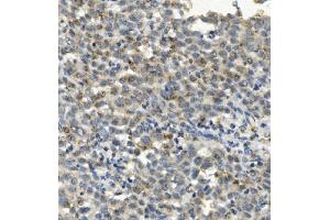 IHC analysis of CCR2 using anti-CCR2 antibody (ABIN7598970).