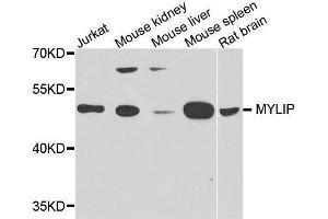 Western blot analysis of extracts of various cell lines, using MYLIP antibody. (MYLIP anticorps  (AA 266-445))