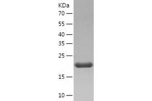 Western Blotting (WB) image for ADP-Ribosylation Factor-Like 3 (ARL3) (AA 1-182) protein (His tag) (ABIN7121745)