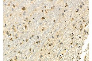 ABIN6262343 and ABIN6279489 at 1/100 staining Rat brain tissue by IHC-P. (HOXB3 anticorps  (C-Term))